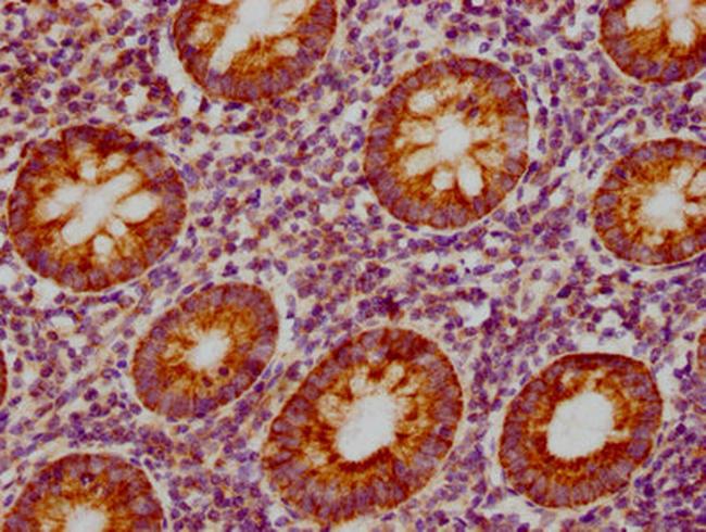 MIP-3 beta Antibody in Immunohistochemistry (Paraffin) (IHC (P))