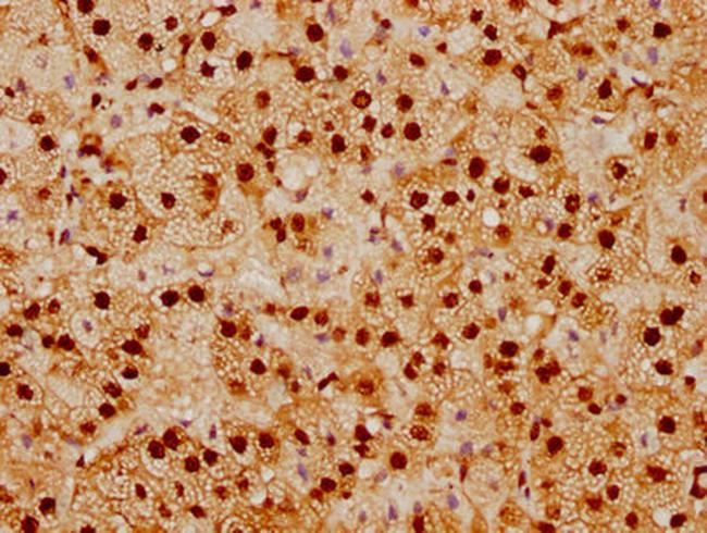 SUMO1 Antibody in Immunohistochemistry (Paraffin) (IHC (P))