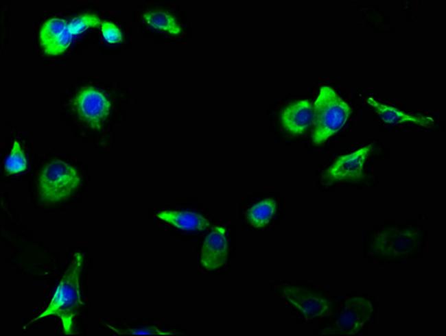 GluR2/GluR3 Antibody in Immunocytochemistry (ICC/IF)