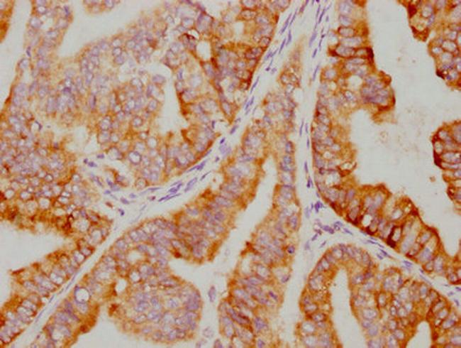 IkB alpha Antibody in Immunohistochemistry (Paraffin) (IHC (P))