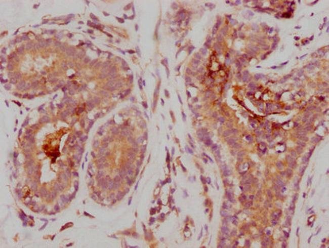 MMP9 Antibody in Immunohistochemistry (Paraffin) (IHC (P))