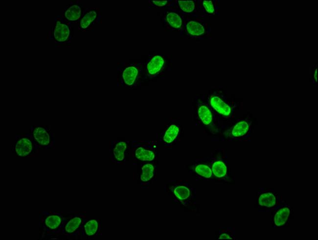 Lamin A Antibody in Immunocytochemistry (ICC/IF)