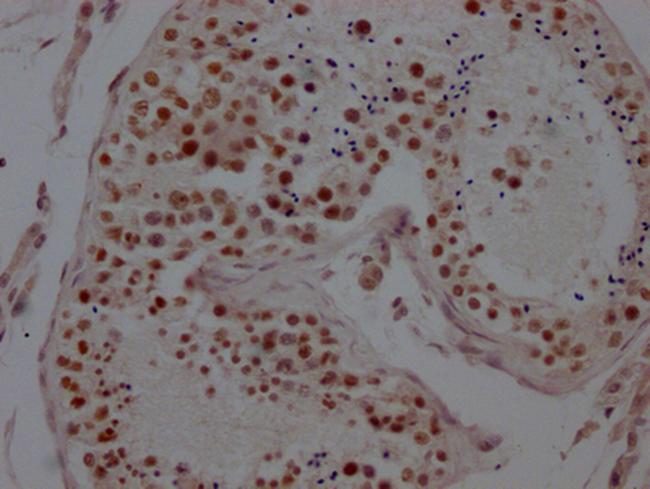 LSD1 Antibody in Immunohistochemistry (Paraffin) (IHC (P))