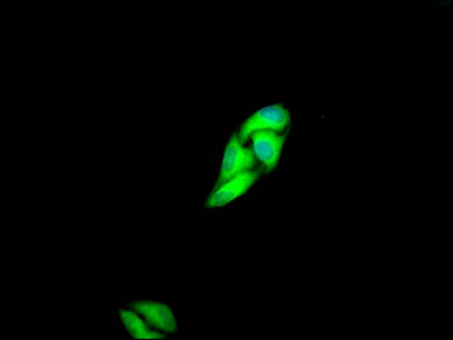 c-Met Antibody in Immunocytochemistry (ICC/IF)