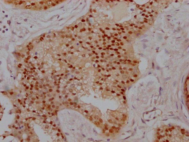 PRMT5 Antibody in Immunohistochemistry (Paraffin) (IHC (P))