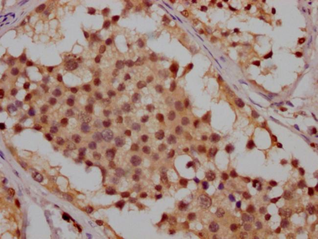 ATM Antibody in Immunohistochemistry (Paraffin) (IHC (P))