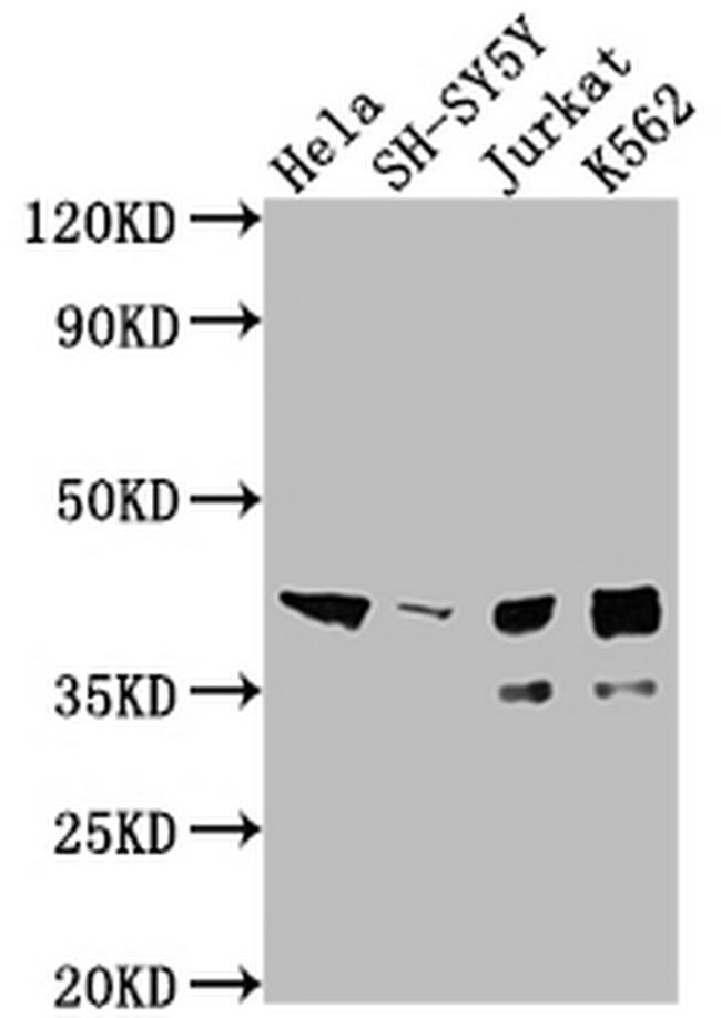 ISL1 Antibody in Western Blot (WB)