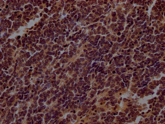 TERT Antibody in Immunohistochemistry (Paraffin) (IHC (P))