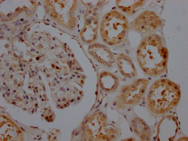 SIRT5 Antibody in Immunohistochemistry (Paraffin) (IHC (P))