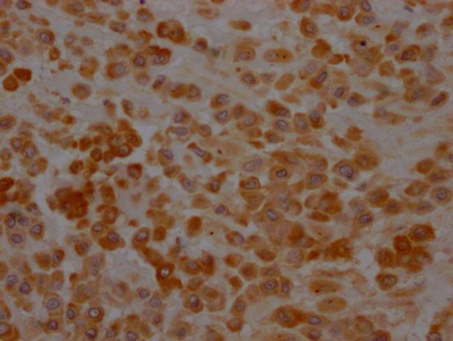 SERPINH1 Antibody in Immunohistochemistry (Paraffin) (IHC (P))