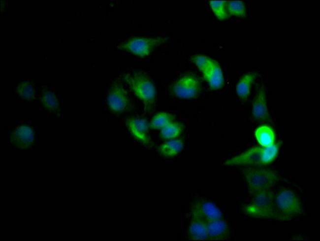 CXCR4 Antibody in Immunocytochemistry (ICC/IF)