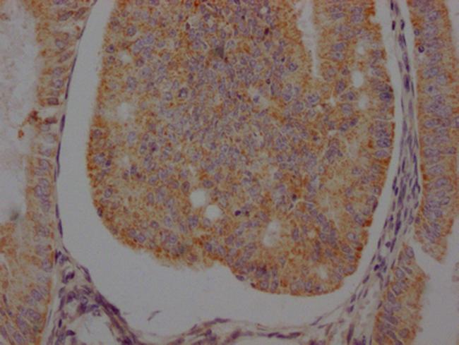 beta-2 Adrenergic Receptor Antibody in Immunohistochemistry (Paraffin) (IHC (P))