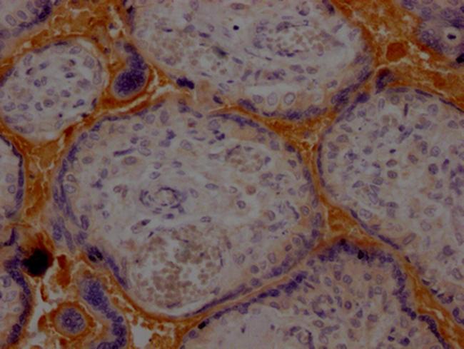 Haptoglobin Antibody in Immunohistochemistry (Paraffin) (IHC (P))