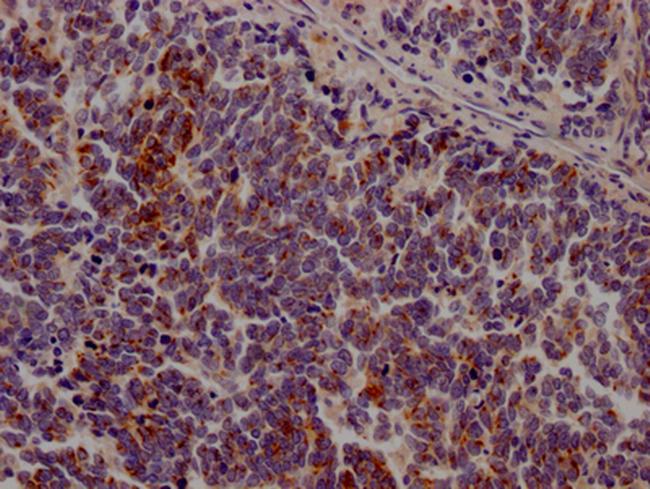 JAK3 Antibody in Immunohistochemistry (Paraffin) (IHC (P))