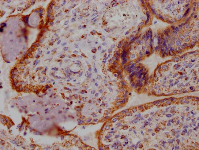 Angiopoietin 2 Antibody in Immunohistochemistry (Paraffin) (IHC (P))