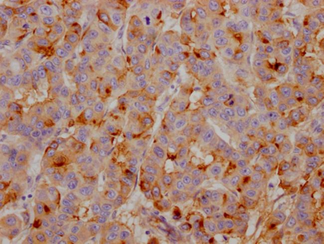 Apolipoprotein J Antibody in Immunohistochemistry (Paraffin) (IHC (P))