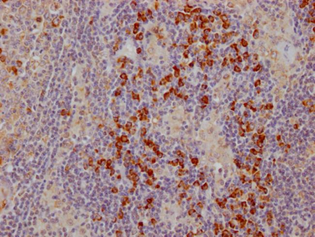 CTLA-4 Antibody in Immunohistochemistry (Paraffin) (IHC (P))