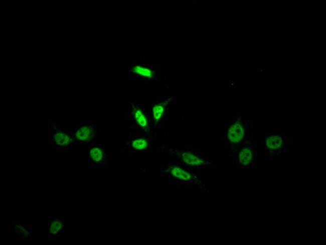 SKP2 Antibody in Immunocytochemistry (ICC/IF)