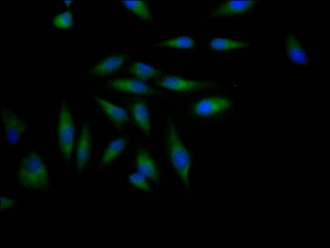 ADAM17 Antibody in Immunocytochemistry (ICC/IF)