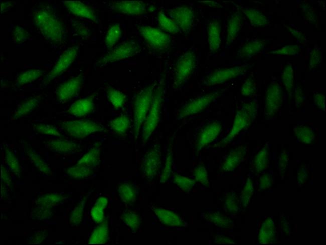 HIF-2 alpha Antibody in Immunocytochemistry (ICC/IF)