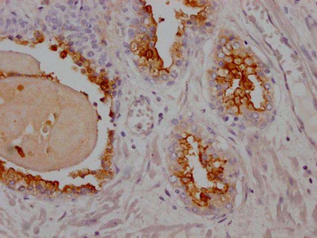 PSMA Antibody in Immunohistochemistry (Paraffin) (IHC (P))