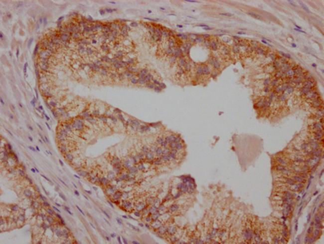 B-Raf Antibody in Immunohistochemistry (Paraffin) (IHC (P))