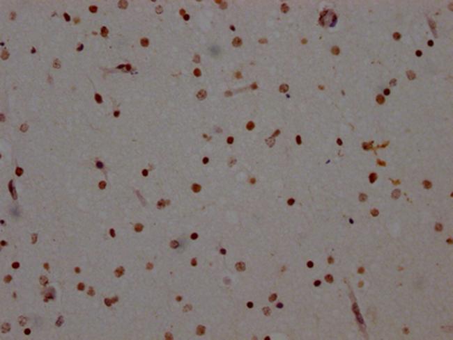 ADAR1 Antibody in Immunohistochemistry (Paraffin) (IHC (P))