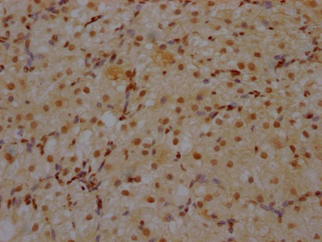 CRM1 Antibody in Immunohistochemistry (Paraffin) (IHC (P))