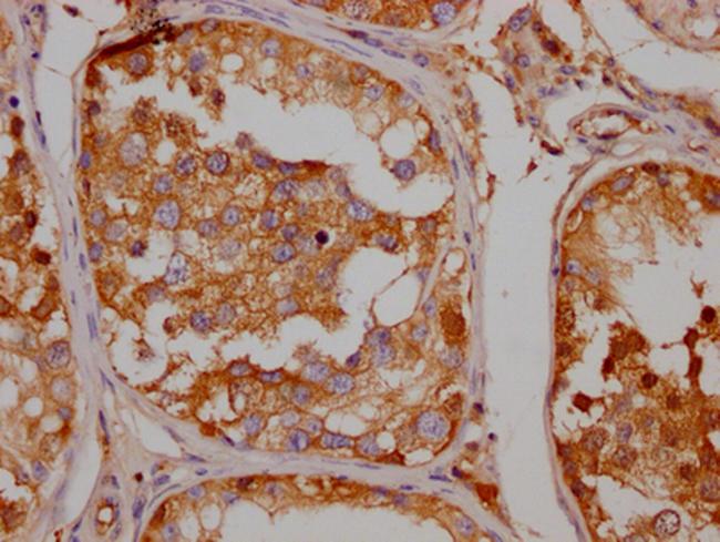 SLC6A4 Antibody in Immunohistochemistry (Paraffin) (IHC (P))