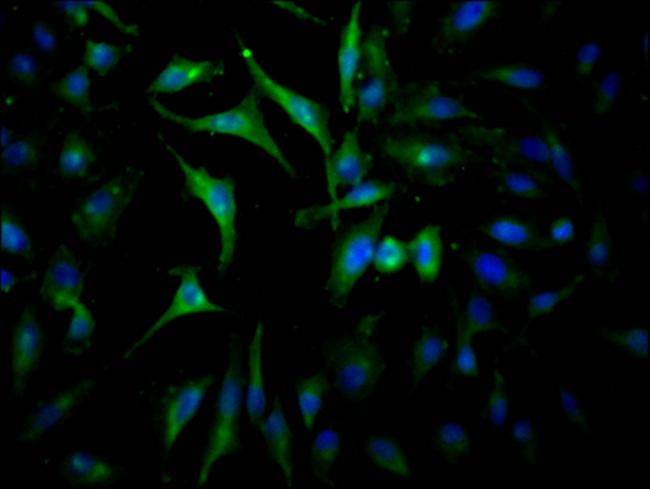 JAK2 Antibody in Immunocytochemistry (ICC/IF)