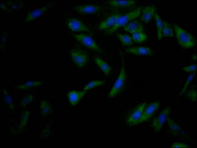 Nrf2 Antibody in Immunocytochemistry (ICC/IF)