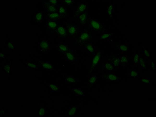 HIF1A Antibody in Immunocytochemistry (ICC/IF)