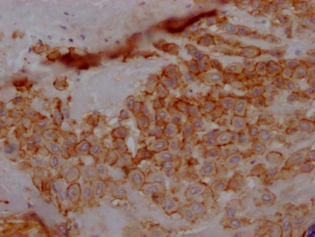 5T4 Antibody in Immunohistochemistry (Paraffin) (IHC (P))