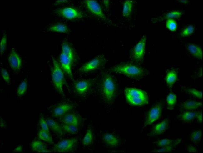 RHEB Antibody in Immunocytochemistry (ICC/IF)