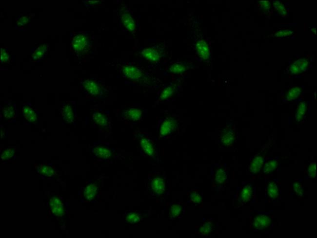 ILF3 Antibody in Immunocytochemistry (ICC/IF)