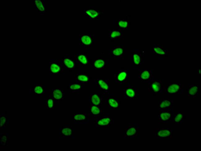 NONO Antibody in Immunocytochemistry (ICC/IF)