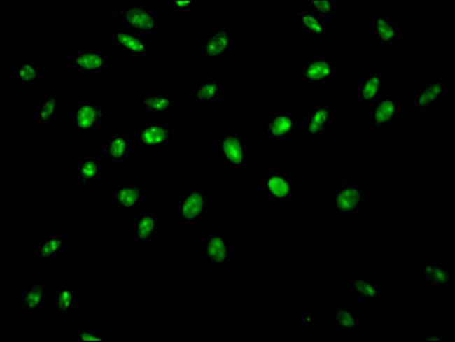 HnRNP Q Antibody in Immunocytochemistry (ICC/IF)