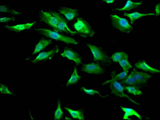 GSK3B Antibody in Immunocytochemistry (ICC/IF)