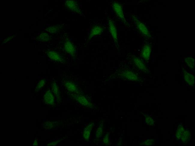 RNF20 Antibody in Immunocytochemistry (ICC/IF)