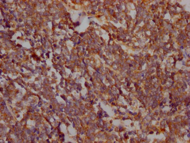 FAK Antibody in Immunohistochemistry (Paraffin) (IHC (P))