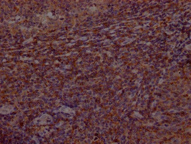 Btk Antibody in Immunohistochemistry (Paraffin) (IHC (P))