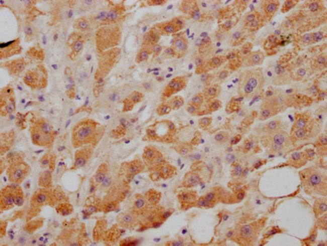 NPC1L1 Antibody in Immunohistochemistry (Paraffin) (IHC (P))