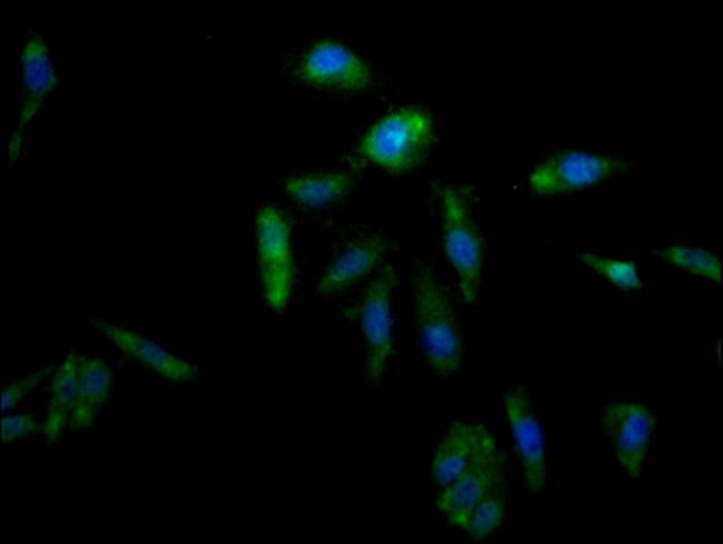 AKR1C3 Antibody in Immunocytochemistry (ICC/IF)