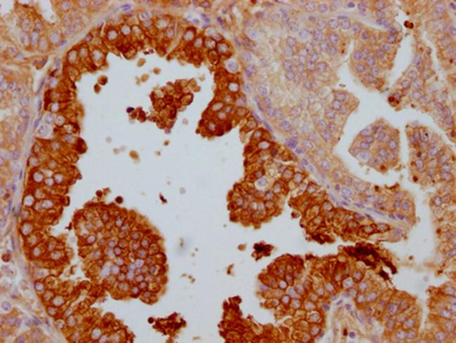 Lactoferrin Antibody in Immunohistochemistry (Paraffin) (IHC (P))