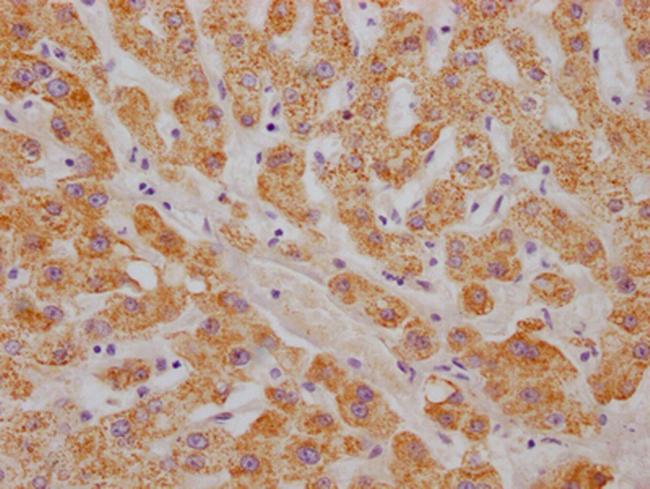 ABAT Antibody in Immunohistochemistry (Paraffin) (IHC (P))