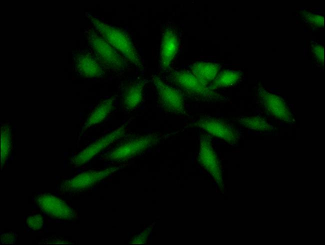 SKP2 Antibody in Immunocytochemistry (ICC/IF)