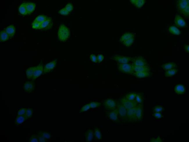 SENP1 Antibody in Immunocytochemistry (ICC/IF)