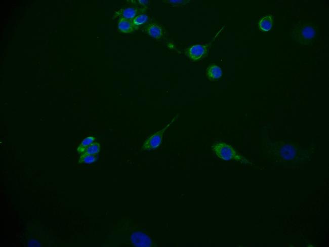 CD49f Antibody in Immunocytochemistry (ICC/IF)