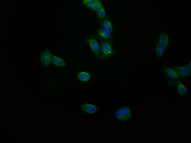 JNK3 Antibody in Immunocytochemistry (ICC/IF)