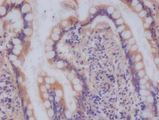 NDUFS4 Antibody in Immunohistochemistry (Paraffin) (IHC (P))